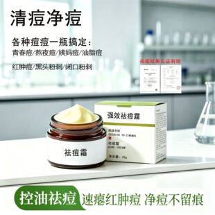 Beauty Salons Specialize in Anti-Acne Cream to Remove Acne, Closed Comedones, and Pimples, with Strong Oil Control, Leaves No Marks, and No Need for Needle Removal