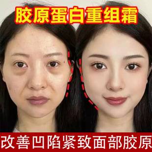 Type Iii Collagen Restructuring Cream Fills Facial Depressions, Tear Troughs, Reduces Fine Lines, Tightens and Resists Early Signs of Aging, Multi-Peptide Face Cream