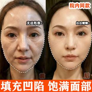 Restructured Collagen Filling Cream, Small Molecule Lifting, Firming, Lightening Wrinkles, Moisturizing, Anti-Wrinkle and Rejuvenating Essence Cream