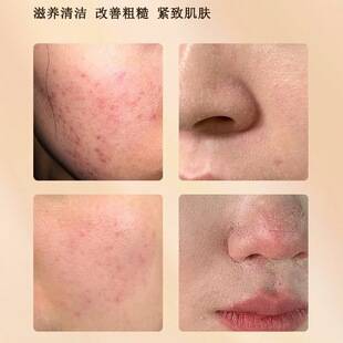 Su Xiuchen's Ginseng Thorns Cream Essence Cream Locks in Moisture, Rejuvenates and Repairs Facial Blemishes, and Moisturizes the Skin