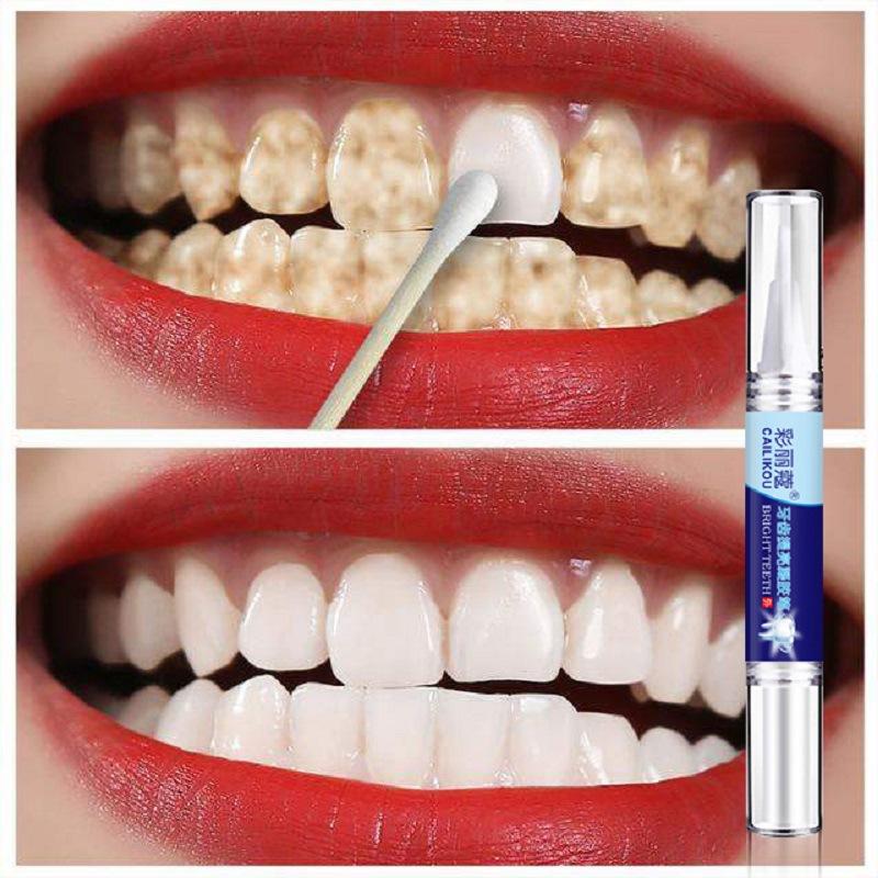 Teeth whitening pen teeth care remove yellow teeth smoke teeth remove tea stains fast teeth cleansing teeth brightening pen