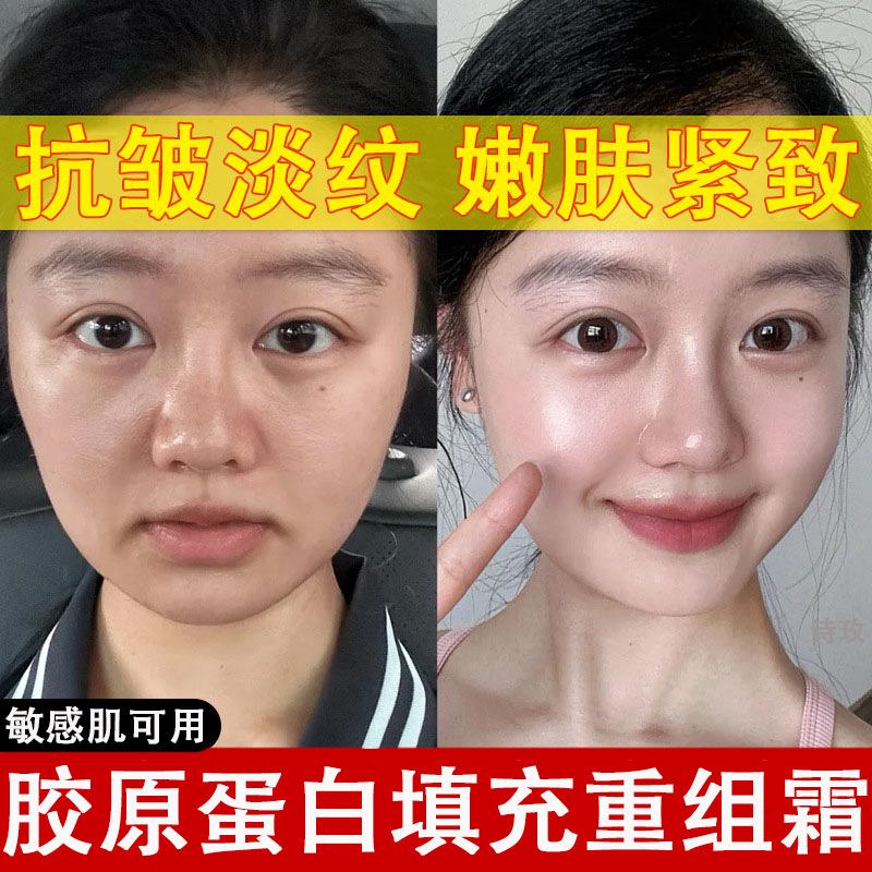 Collagen Filling Cream, Anti-Wrinkle Firming Cream, Anti-Aging Cream, Filling Sunken Areas, Rejuvenating Cream, Restructuring Cream