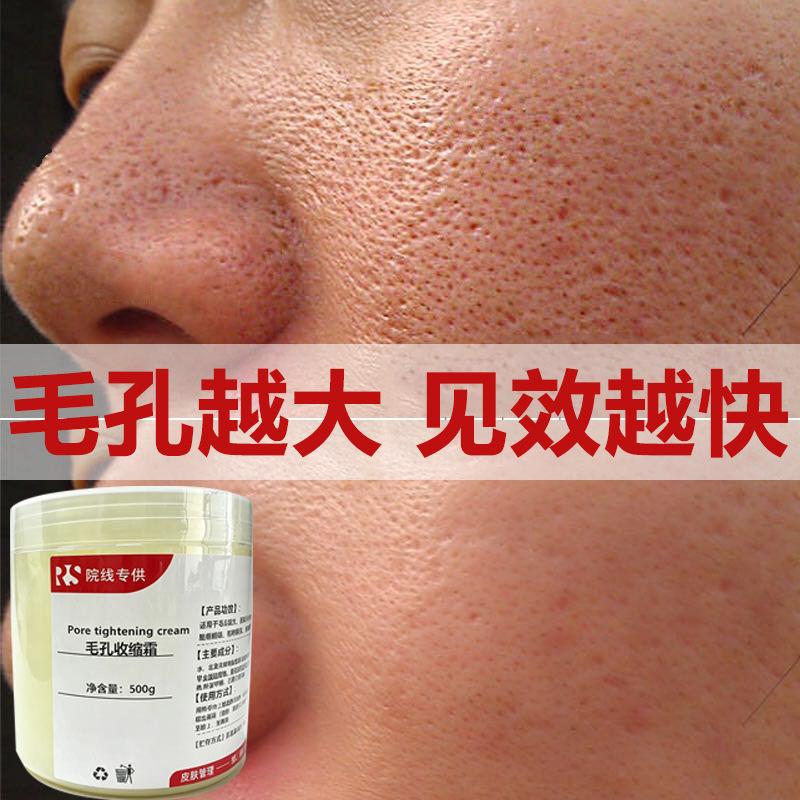 Pore-minimizing cream refines pores, removes blackheads, eliminates whiteheads, reduces acne marks and scars, and repairs pores