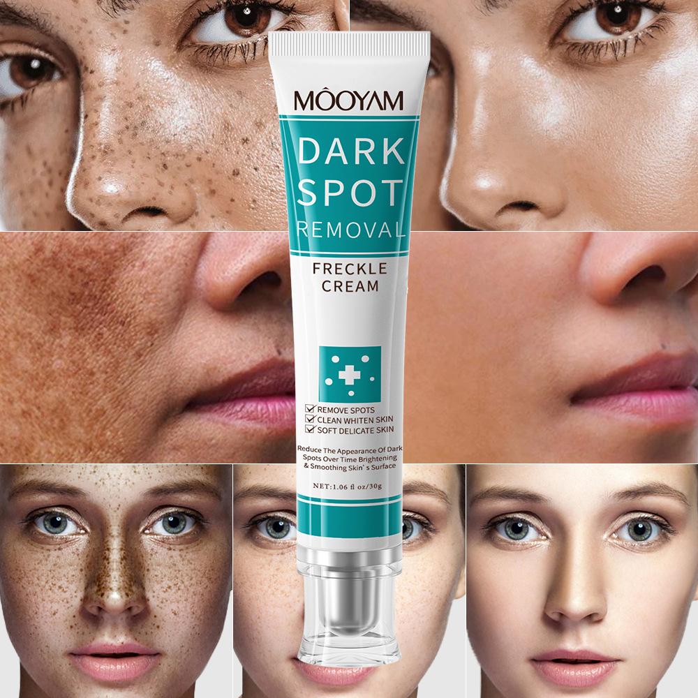Dark Spot Removal Cream, Black Spot Face Cream, Whitening Freckle Cream