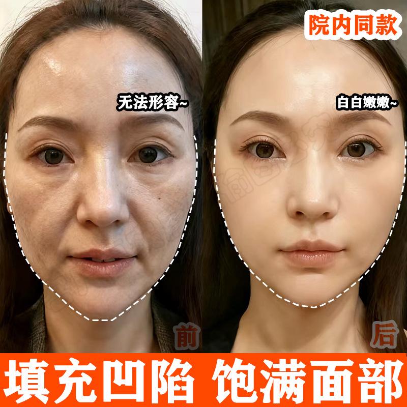 Restructured Collagen Filling Cream, Small Molecule Lifting, Firming, Lightening Wrinkles, Moisturizing, Anti-Wrinkle and Rejuvenating Essence Cream