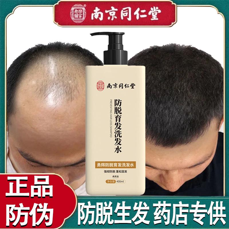 Nanjing Tongrentang Ginger Shampoo Anti-Hair Loss Hair Growth Liquid for Baldness, Hairline Enhancement, Hair Thickening, Anti-Dandruff, Genuine Product