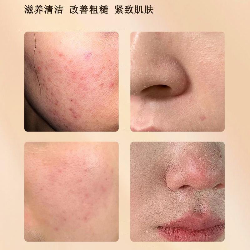 Su Xiuchen's Ginseng Thorns Cream Essence Cream Locks in Moisture, Rejuvenates and Repairs Facial Blemishes, and Moisturizes the Skin